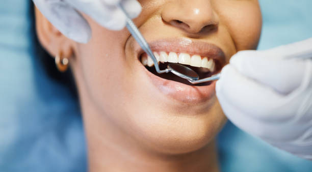 Best Emergency Treatment for Dental Infections or Abscesses in Selma, AL